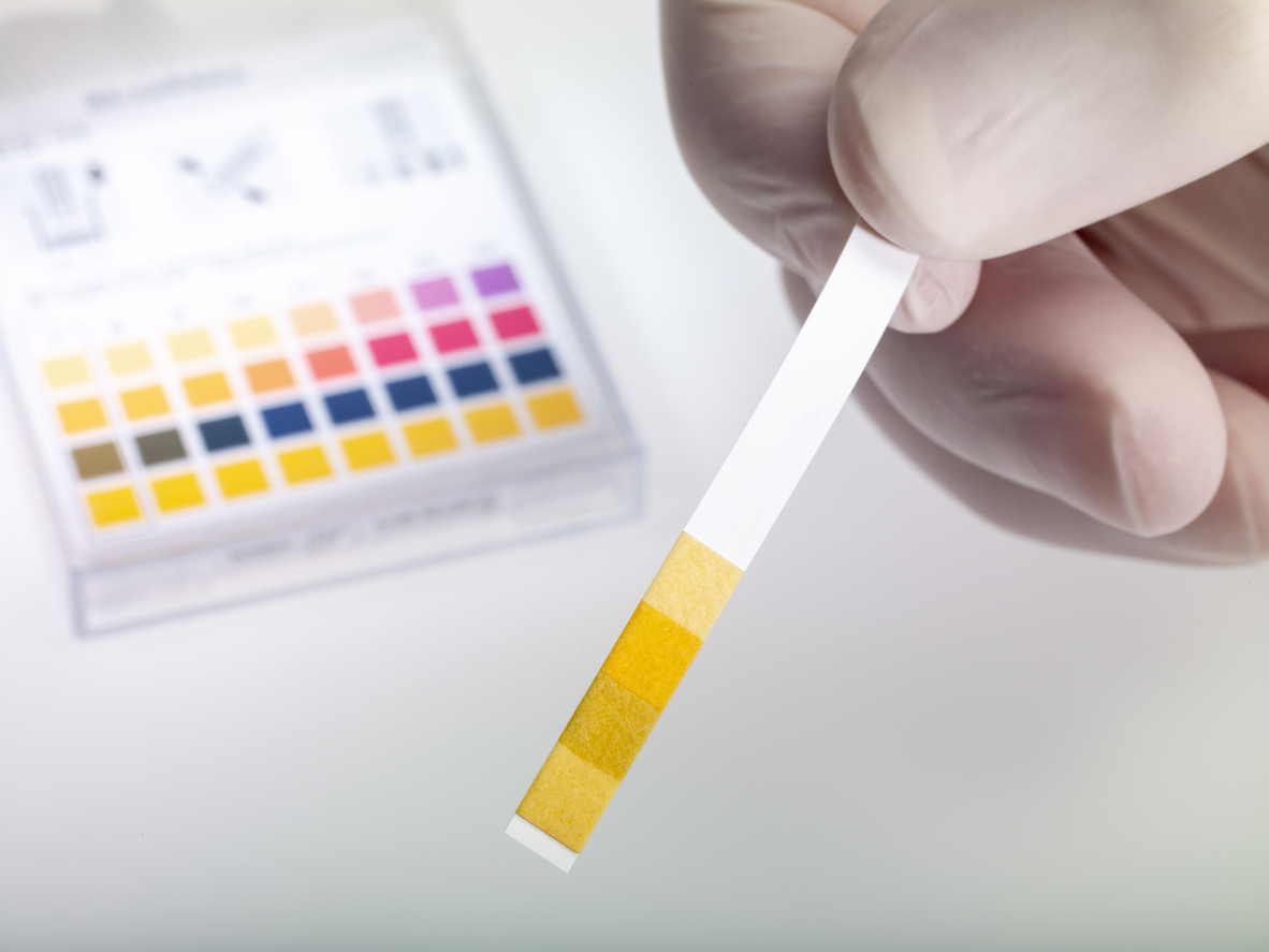 someone testing water pH with a strip test